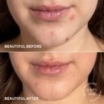 TULA Skin Care Brightening Treatment Drops - Vitamin C Serum, Brightens the Look of Dull Skin & Dark Spots, 1 fl oz. - Image 3
